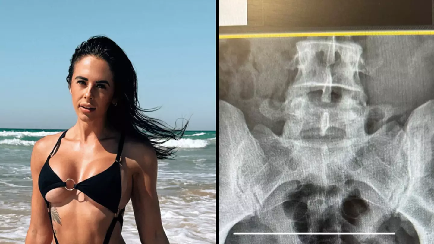 Alicia Davis, Atriz Pornô, Enfrenta Cirurgia de Emergência Após Acidente com Plug Anal